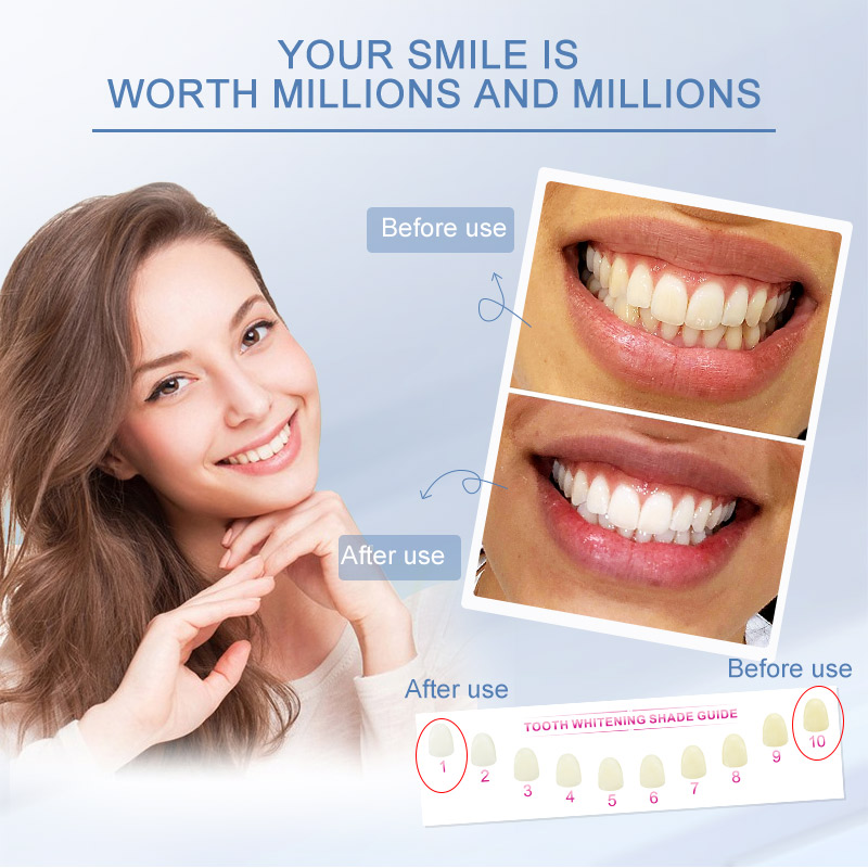 Large Capacity Whitening Gel Cost-Effective Home Teeth Whitening Kit